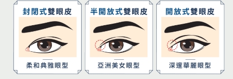 雙眼皮