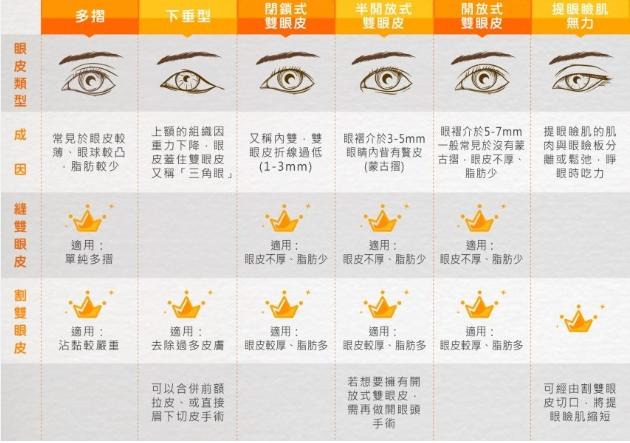 內雙怎麼變外雙