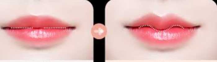 唇珠