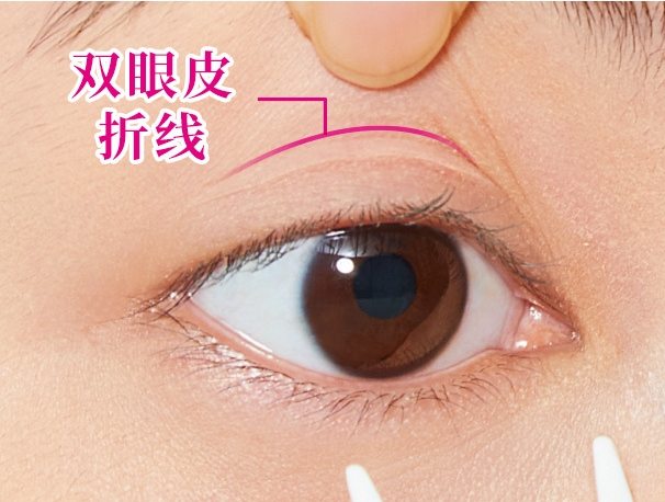 貼雙眼皮貼睡覺會怎樣