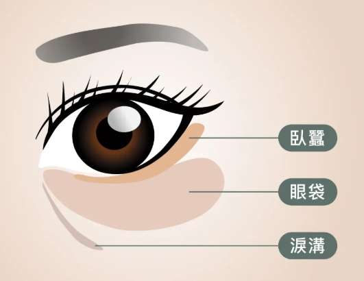 眼袋消除手術 眼袋消除手術