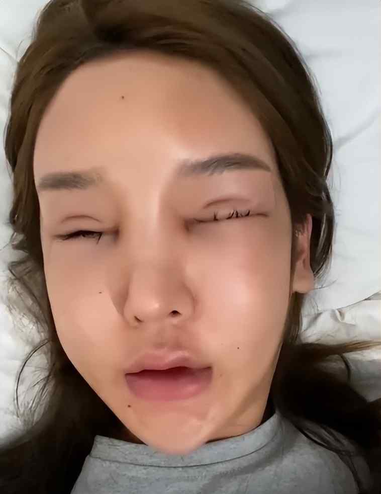 整形手術的風險性 整形手術的風險性